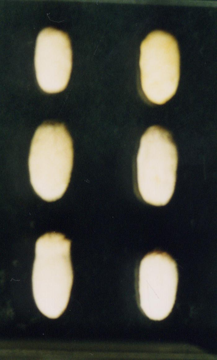 986_387